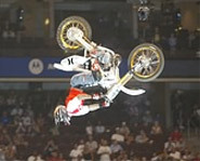 Carey Hart has had dozens of injuries while riding motocross, including broken ribs, concussions and a broken femur.