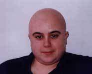 Kat Orr used special make-up FX to make herself bald.