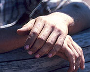 Cracking your knuckles doesn't lead to arthritis.