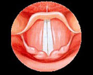 The larynx becomes larger as boys go through puberty. The larger larynx gives boys a deeper voice.