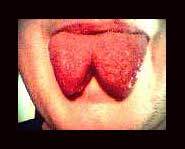 Is this a new trend or just really bad freak of nature?
