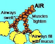 Airways are restricted by spasming muscles, swollen passages and mucus.