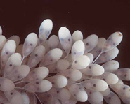 These were found in the girl's stomach!