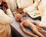 Footage of the alien autopsy.