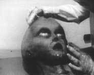 Was the autopsy a fake?