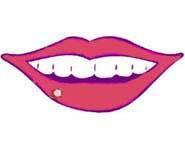 A nasty, ugly cold sore.