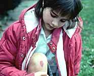 Scabs protect against infection.