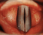 Vocal cords are not actually cords - they're folds!