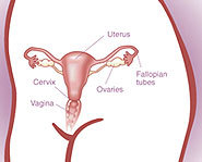 Cervical cancer is cancer of the cervix, but it may be prevented with the HPV vaccine.